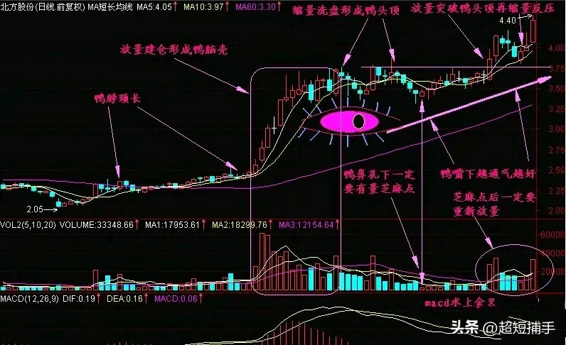 “老鸭头”形态