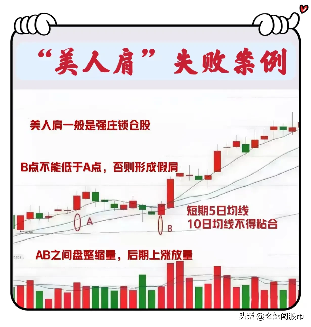 “美人肩”形态