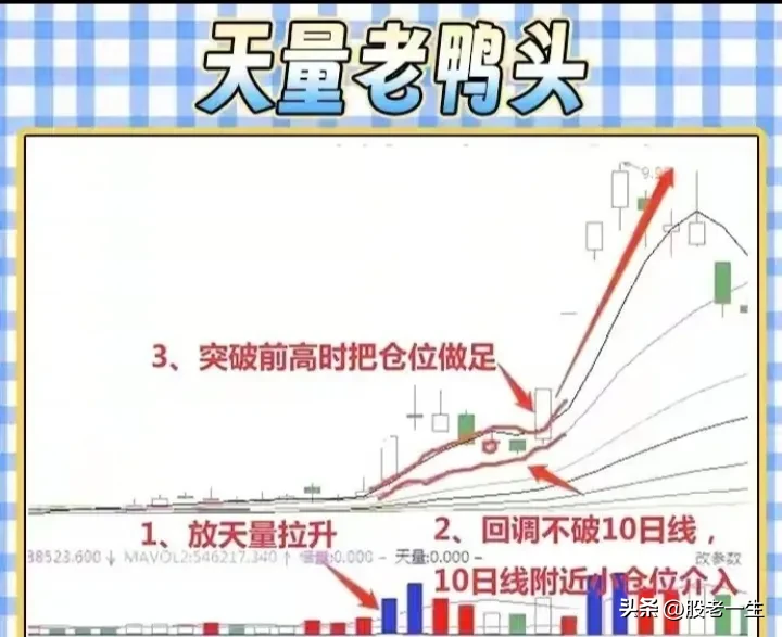 “老鸭头形态”